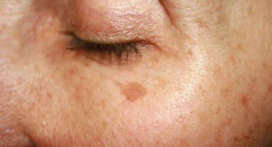 ��� �������� ���������� �����: 4 �������� ��� ������� ����