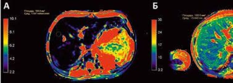 ��������� ��� ��������������� ����������� ������ � ������ � ������� ����������� ��������������������� �������