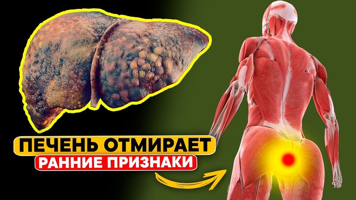 Шесть признаков, что ваша печень требует внимания